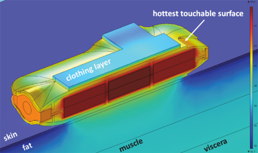 仿真结果为设备、皮肤、衣物及周围区域的温度曲线